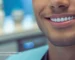 مزایا و معایب لمینت دندان
