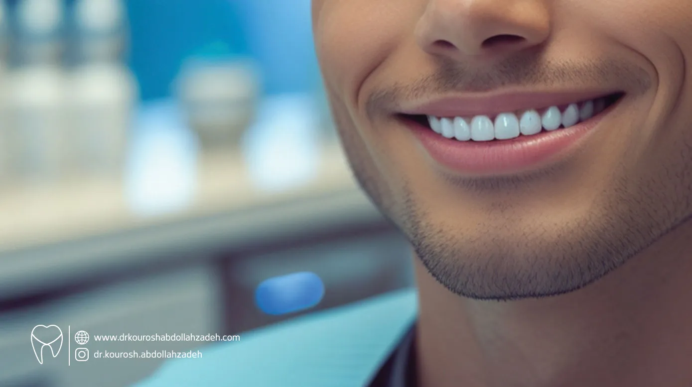 مزایا و معایب لمینت دندان
